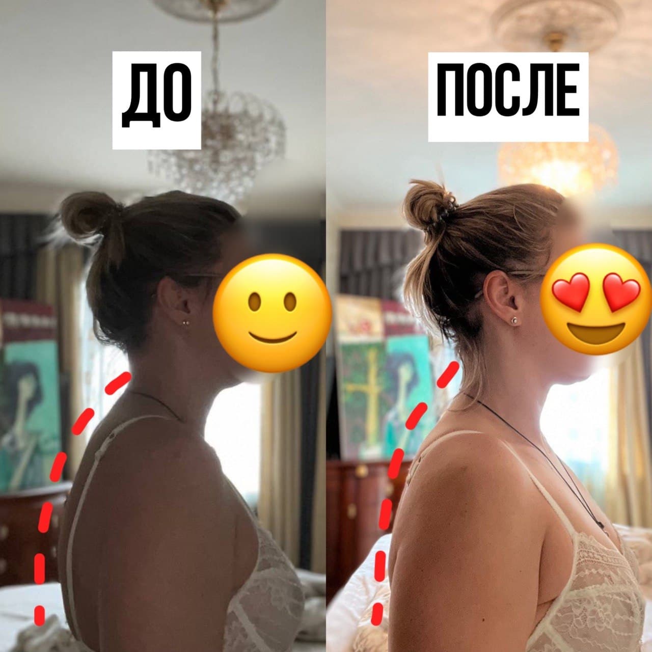 Осанка участницы до и после марафона, фото 1