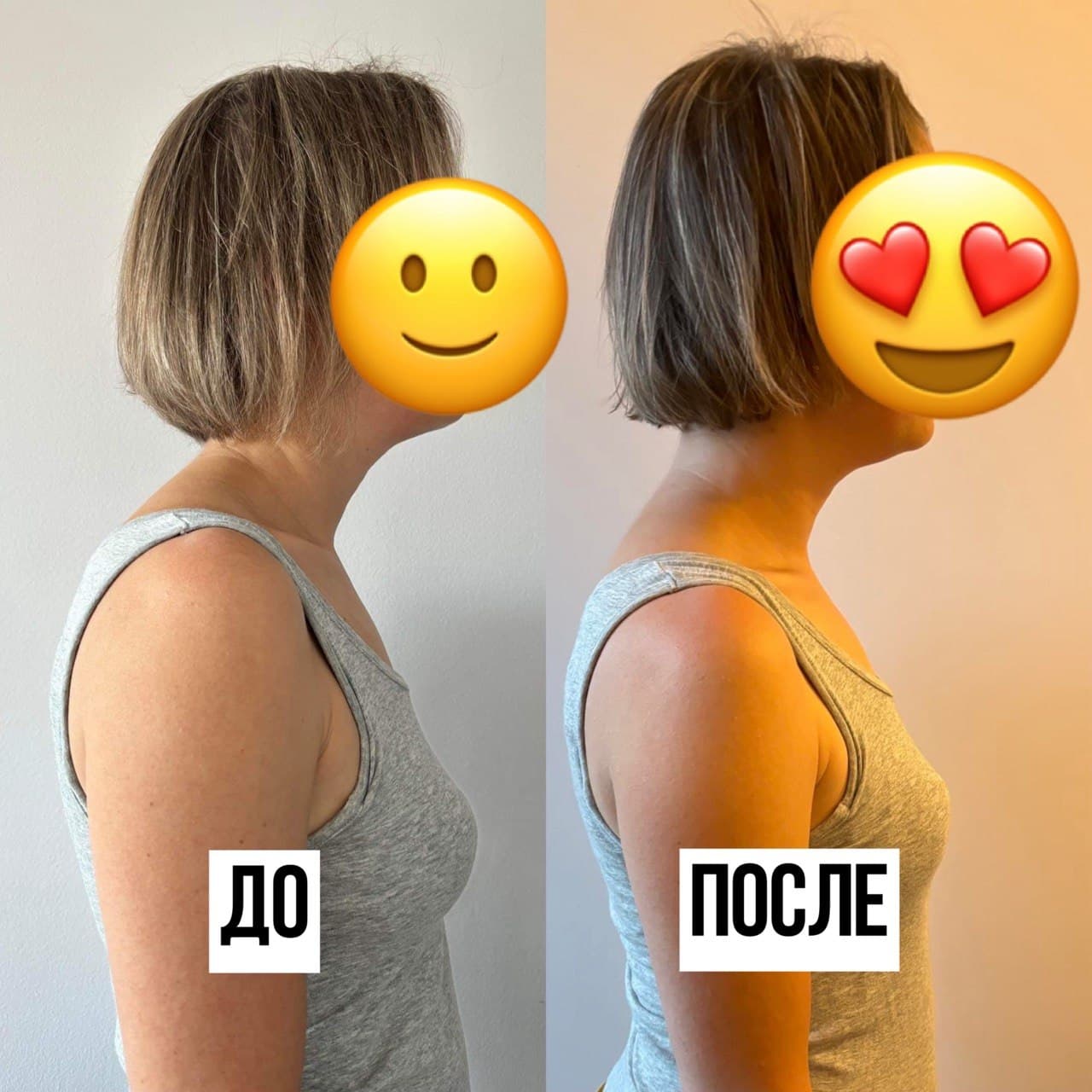Осанка участницы до и после марафона, фото 2