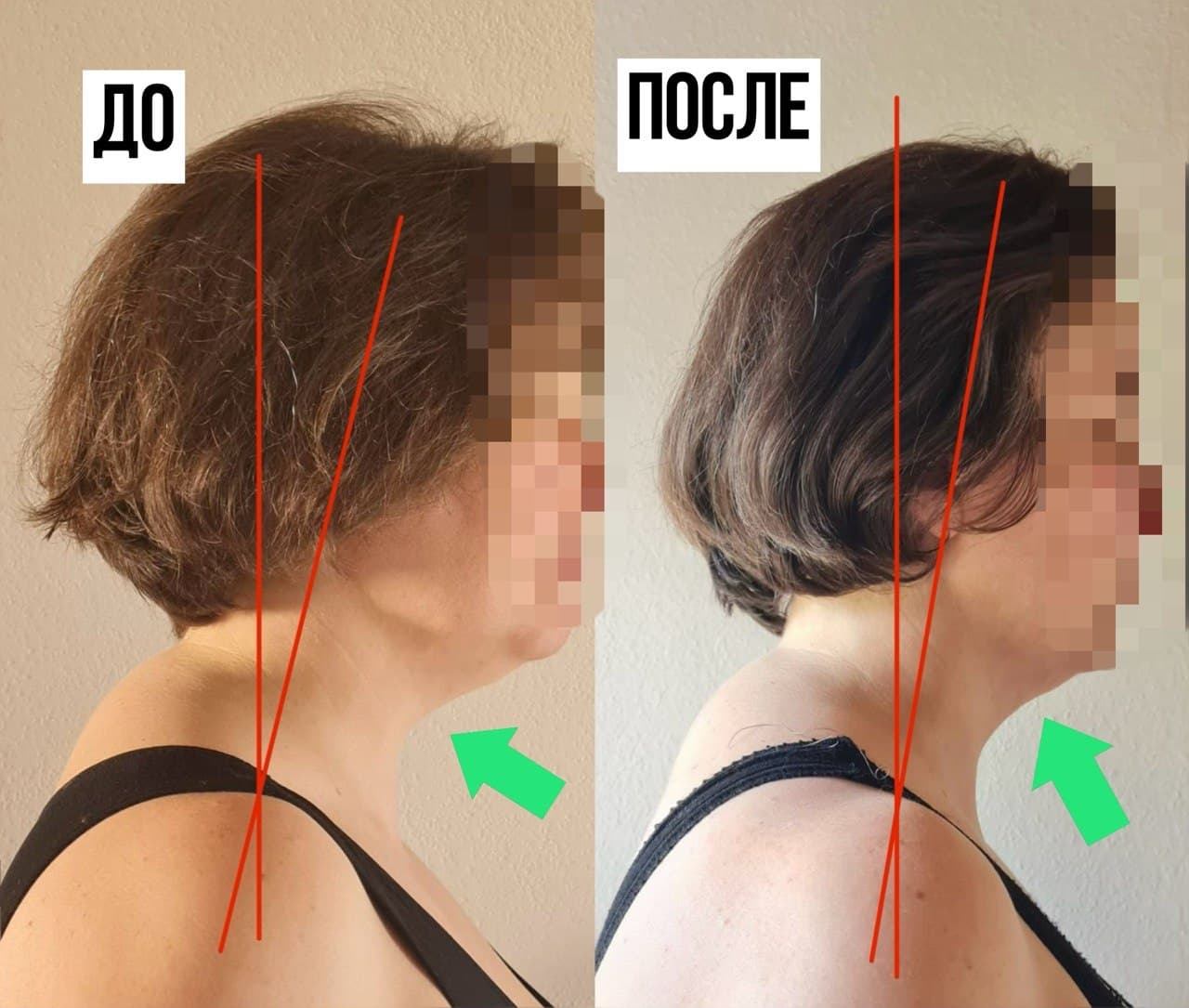 Осанка участницы до и после марафона, фото 3