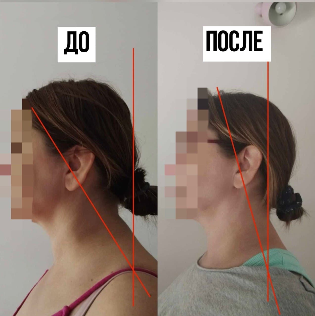 Осанка участницы до и после марафона, фото 4